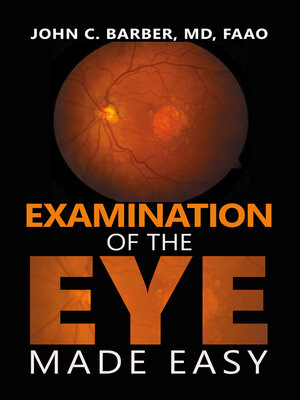 cover image of Examination of the Eye Made Easy